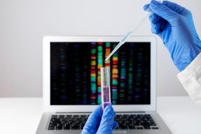 Celldex